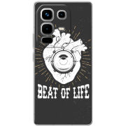 Чохол BoxFace Infinix Note 50 Pro 