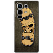 Чохол BoxFace Infinix Note 50 Pro 