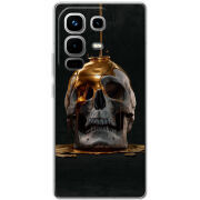 Чохол BoxFace Infinix Note 50 Pro 