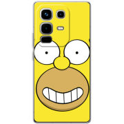 Чохол BoxFace Infinix Note 50 Pro 