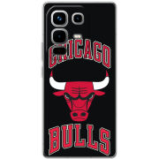 Чохол BoxFace Infinix Note 50 Pro 