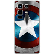 Чохол BoxFace Infinix Note 50 Pro 