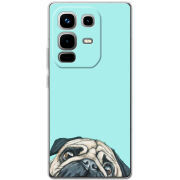 Чохол BoxFace Infinix Note 50 Pro 