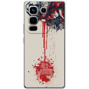 Чохол BoxFace Infinix Note 50 Pro 