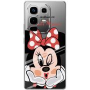 Прозорий чохол BoxFace Infinix Note 50 Pro Lady M