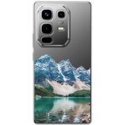 Прозорий чохол BoxFace Infinix Note 50 Pro Blue Mountain