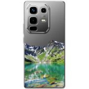 Прозорий чохол BoxFace Infinix Note 50 Pro Green Mountain