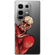 Прозорий чохол BoxFace Infinix Note 50 Pro Титан