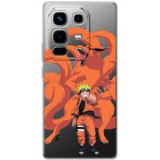 Прозорий чохол BoxFace Infinix Note 50 Pro Naruto and Kurama