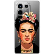 Прозорий чохол BoxFace Infinix Note 50 Pro Фрида Кало