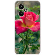 Чохол BoxFace Honor 400 