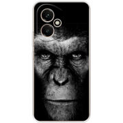 Чохол BoxFace Honor 400 