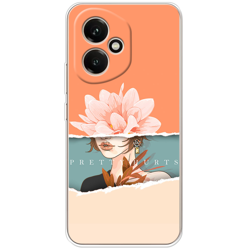 Чохол BoxFace Honor 400 