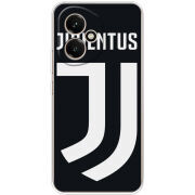 Чохол BoxFace Honor 400 FC J