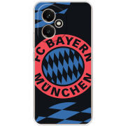 Чохол BoxFace Honor 400 FC Bayern