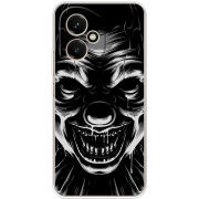 Чохол BoxFace Honor 400 