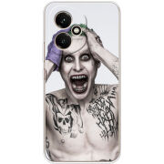 Чохол BoxFace Honor 400 