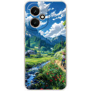 Чохол BoxFace Honor 400 