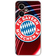 Чохол BoxFace Honor 400 