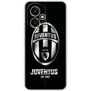 Чохол BoxFace Honor 400 