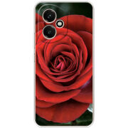 Чохол BoxFace Honor 400 