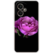 Чохол BoxFace Honor 400 