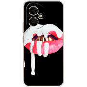 Чохол BoxFace Honor 400 