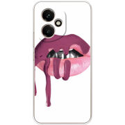 Чохол BoxFace Honor 400 