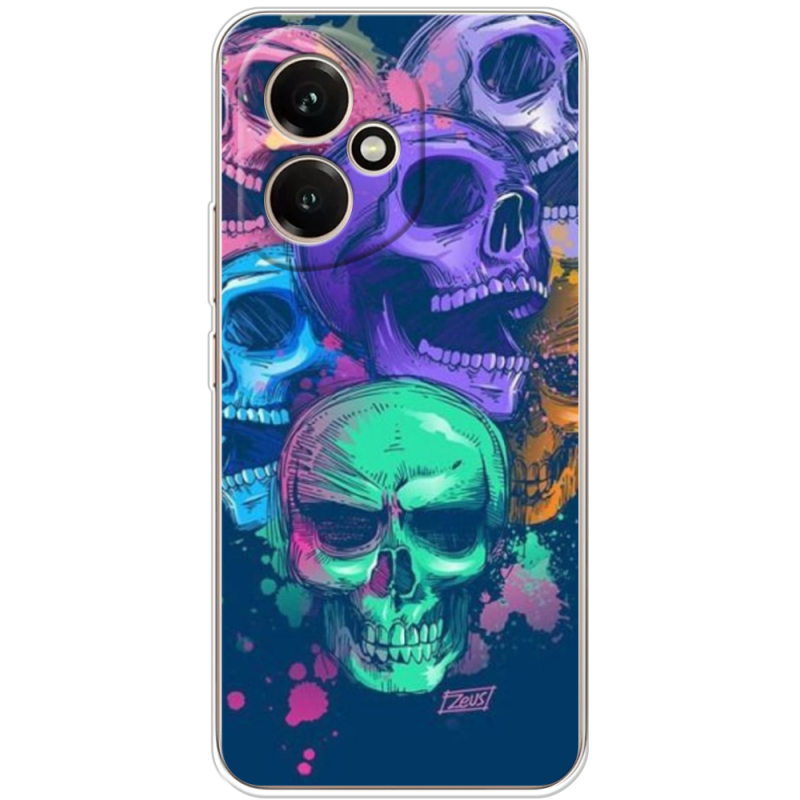 Чохол BoxFace Honor 400 