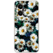 Чохол BoxFace Honor 400 