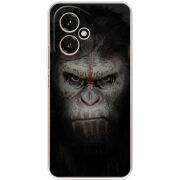 Чохол BoxFace Honor 400 