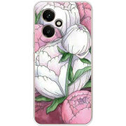 Чохол BoxFace Honor 400 