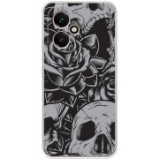 Чохол BoxFace Honor 400 