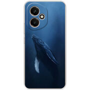 Чохол BoxFace Honor 400 