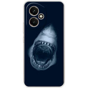 Чохол BoxFace Honor 400 