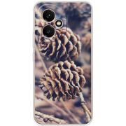 Чохол BoxFace Honor 400 