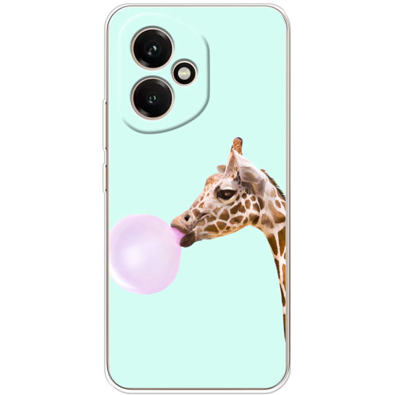 Чохол BoxFace Honor 400 