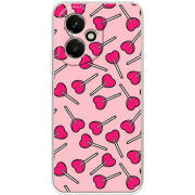 Чохол BoxFace Honor 400 