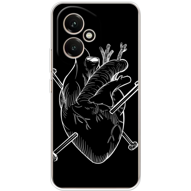 Чохол BoxFace Honor 400 