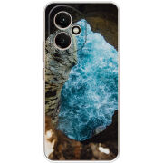 Чохол BoxFace Honor 400 