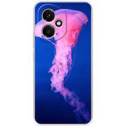 Чохол BoxFace Honor 400 