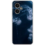 Чохол BoxFace Honor 400 