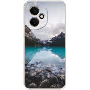 Чохол BoxFace Honor 400 