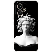 Чохол BoxFace Honor 400 