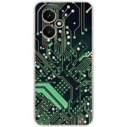 Чохол BoxFace Honor 400 Microchip