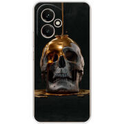 Чохол BoxFace Honor 400 