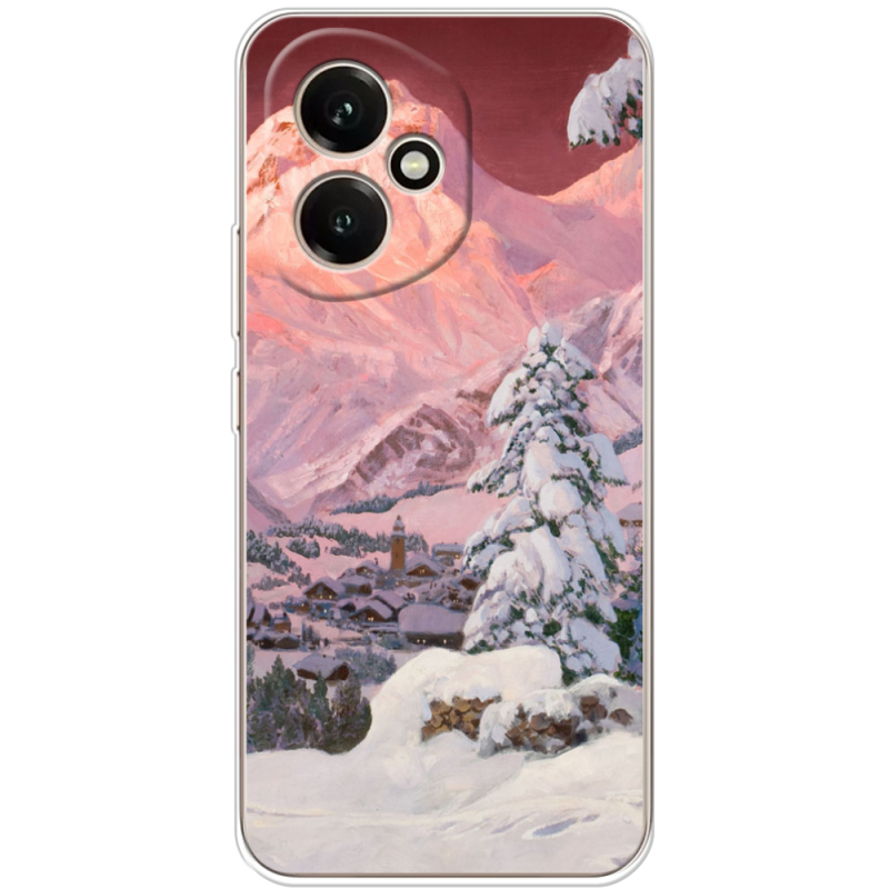 Чохол BoxFace Honor 400 