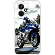 Чохол BoxFace Honor 400 