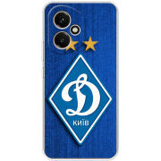Чохол BoxFace Honor 400 Динамо Киев