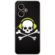 Чохол BoxFace Honor 400 